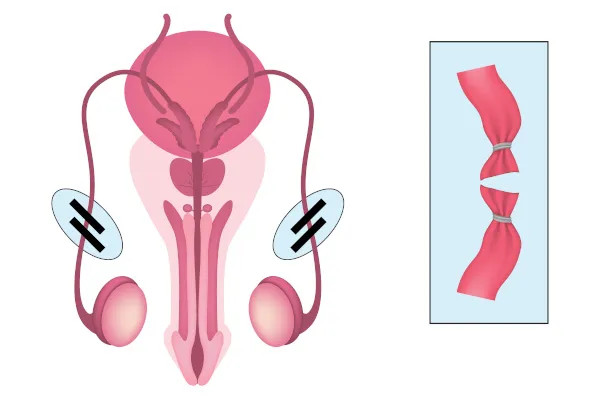 Cirurgia Robótica